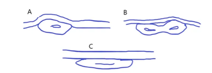 Examples of different fiber-to-fiber bonding structures.